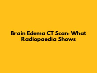 Brain Edema CT Scan: What Radiopaedia Shows