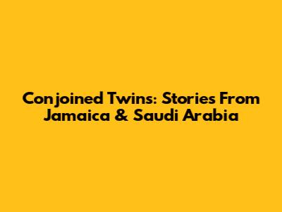 Conjoined Twins: Stories From Jamaica & Saudi Arabia