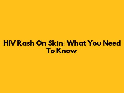 HIV Rash On Skin: What You Need To Know