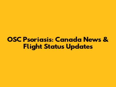 OSC Psoriasis: Canada News & Flight Status Updates
