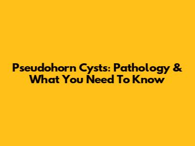 Pseudohorn Cysts: Pathology & What You Need To Know