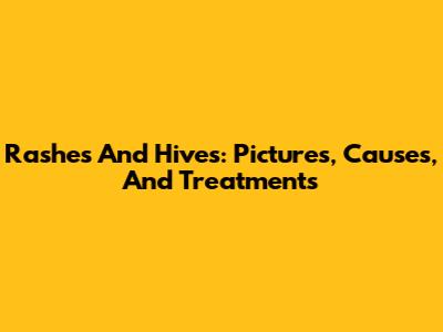 Rashes And Hives: Pictures, Causes, And Treatments