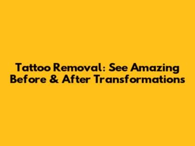 Tattoo Removal: See Amazing Before & After Transformations